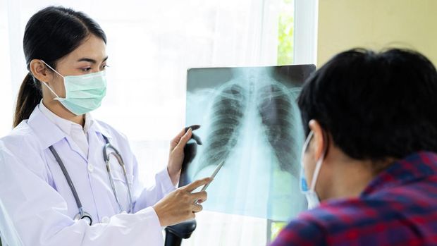 Batuk Tidak Kunjung Sembuh? Cek Risiko TBC
